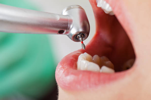 Best Tooth Pain Emergency Relief  in Lorado Springs, CO